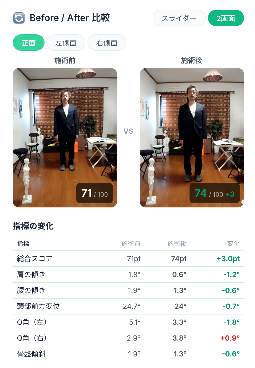 Before/After比較画面